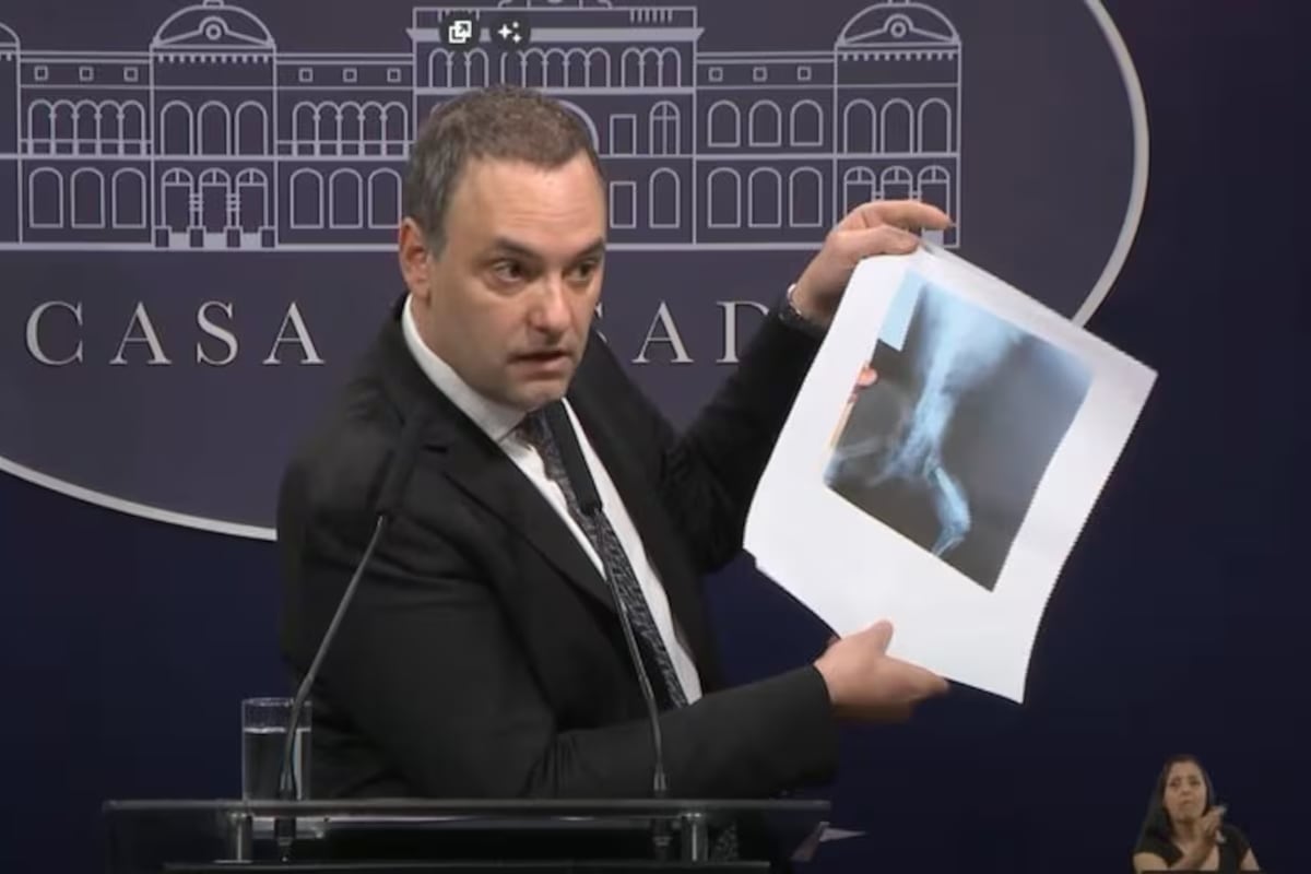 Adorni llegó a utilizar la radiografía trucha de un perro para justificar el ajuste en discapacidad.