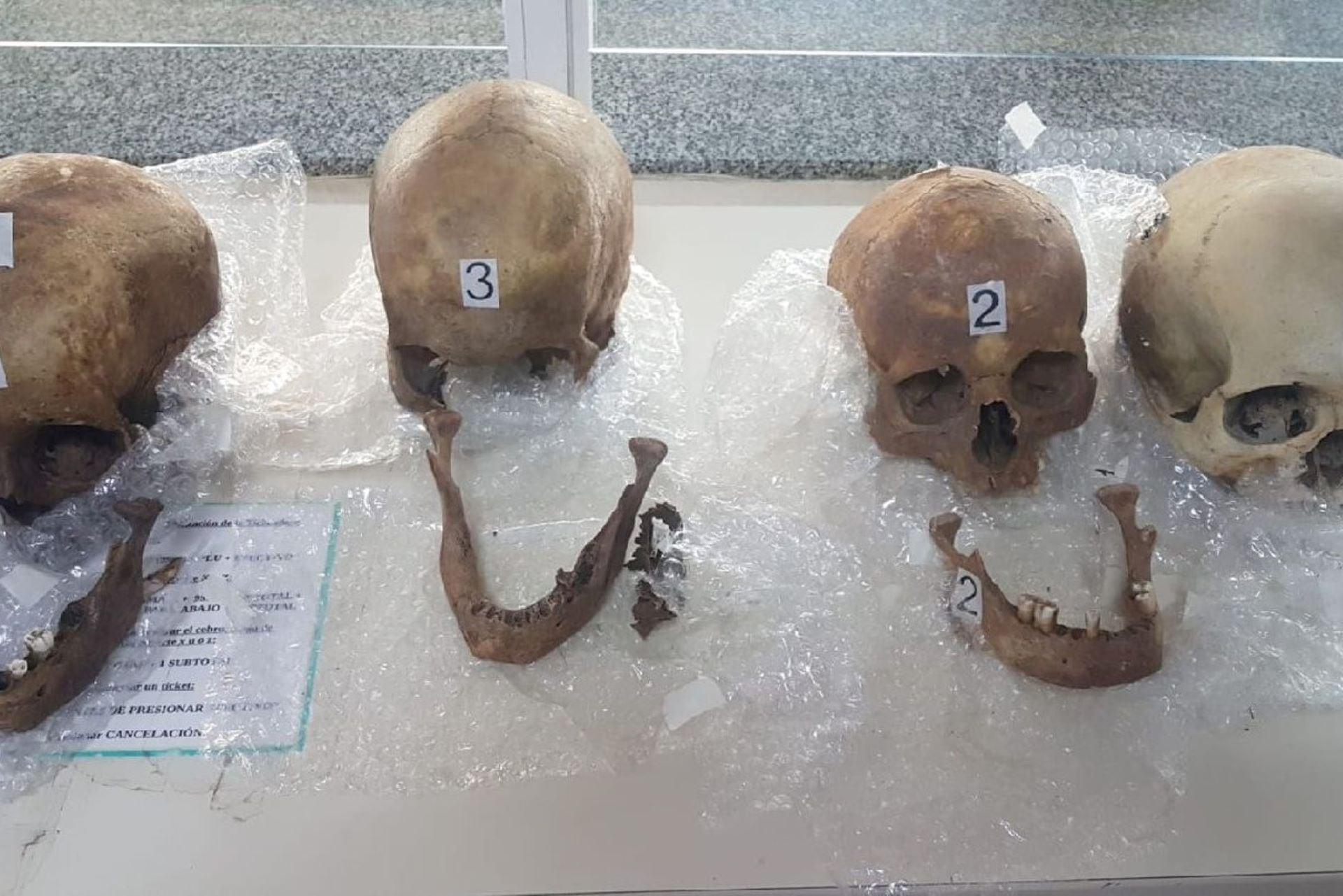 Los cráneos humanos fueron detectados en la valija de una mujer que viajaba desde Paraguay a Buenos Aires. (foto: Aduana)