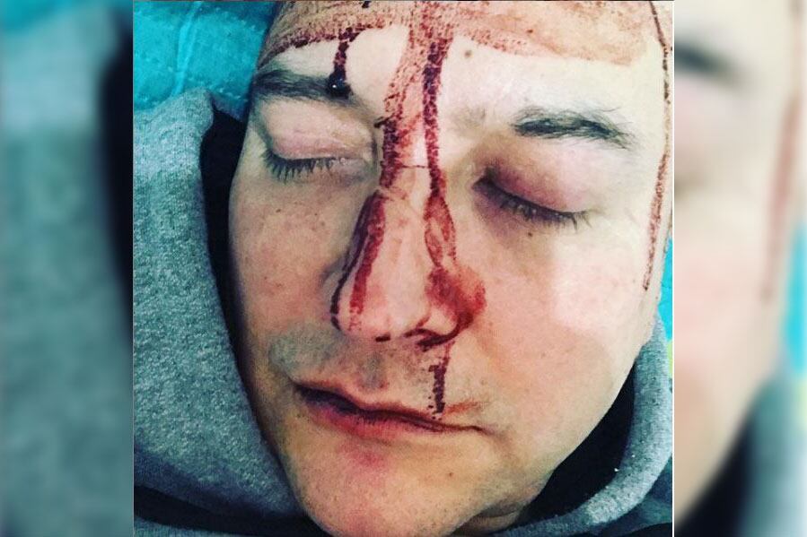 Leo García contó que sufrió un terrible ataque homoodiante.