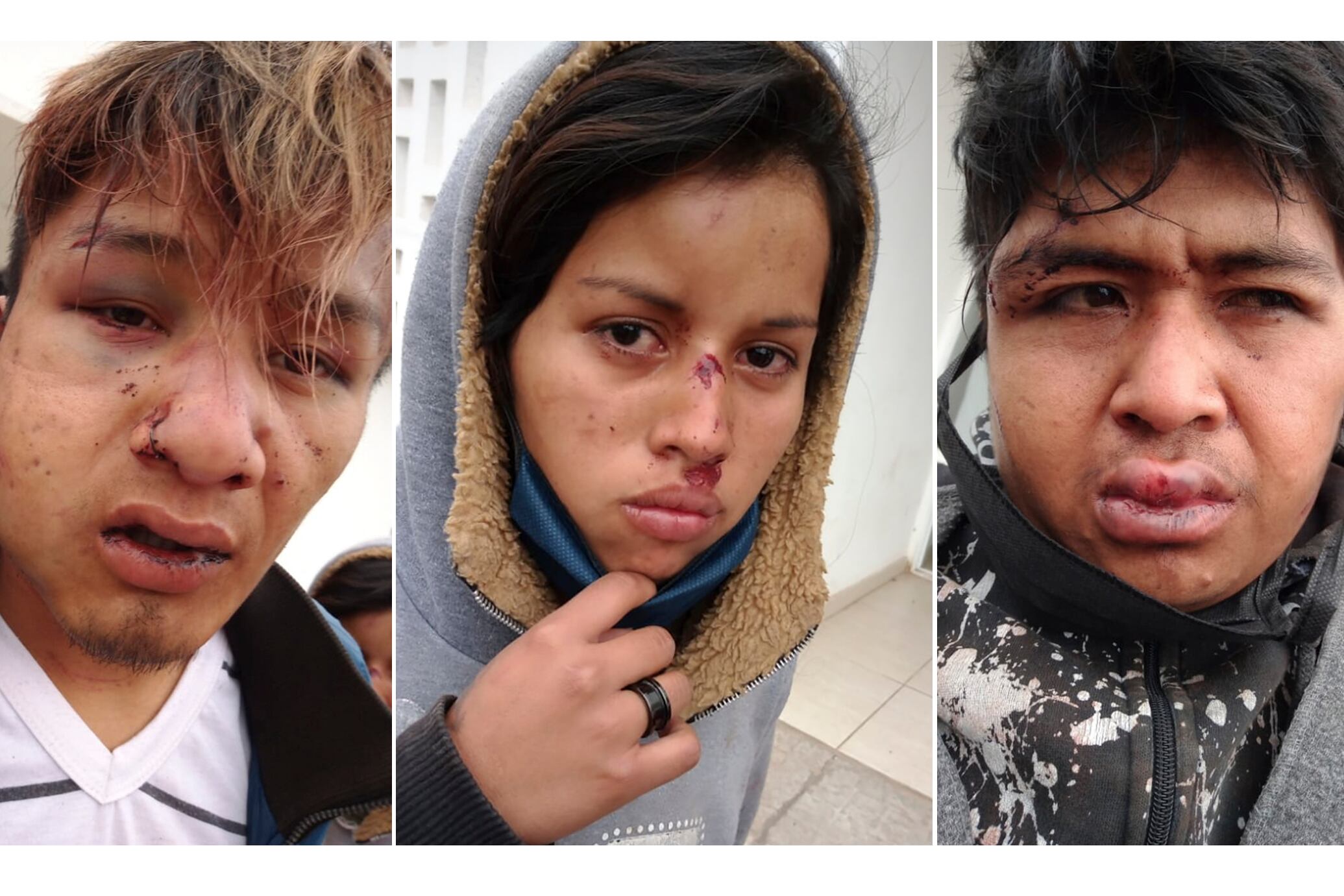 “No calificar como tortura los hechos de Fontana atenúa su gravedad", advierten.