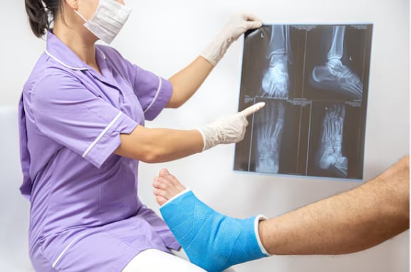 Científicos chinos presentaron un gel adhesivo para reparación de huesos que implica un gran avance científico