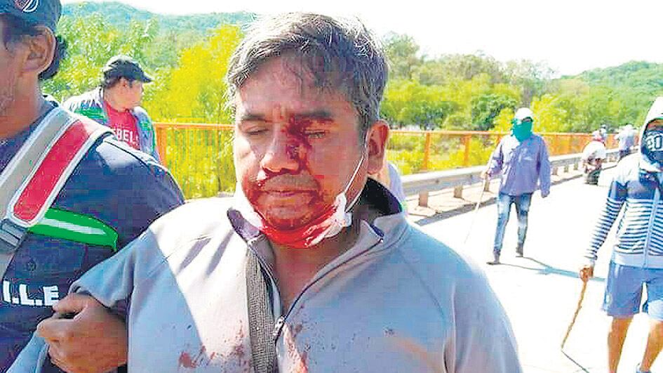 La policía provincial reprimió a los trabajadores del Ingenio La Esperanza.