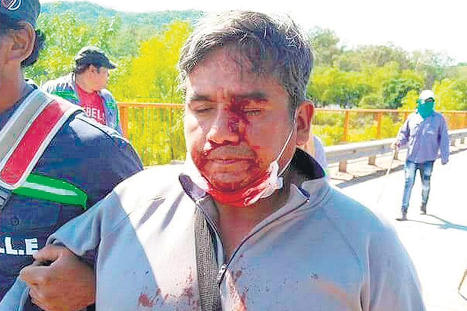 La policía provincial reprimió a los trabajadores del Ingenio La Esperanza.