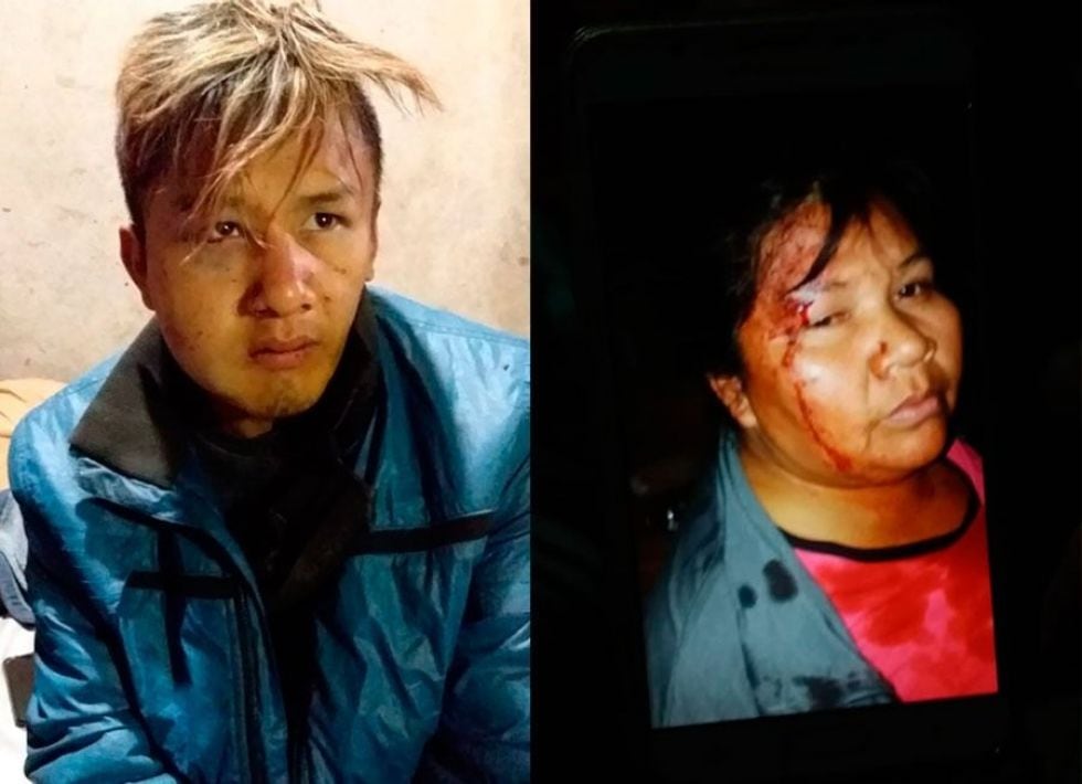 Elsa Fernández y su hijo Cristian, víctimas de la violencia policial en Chaco.