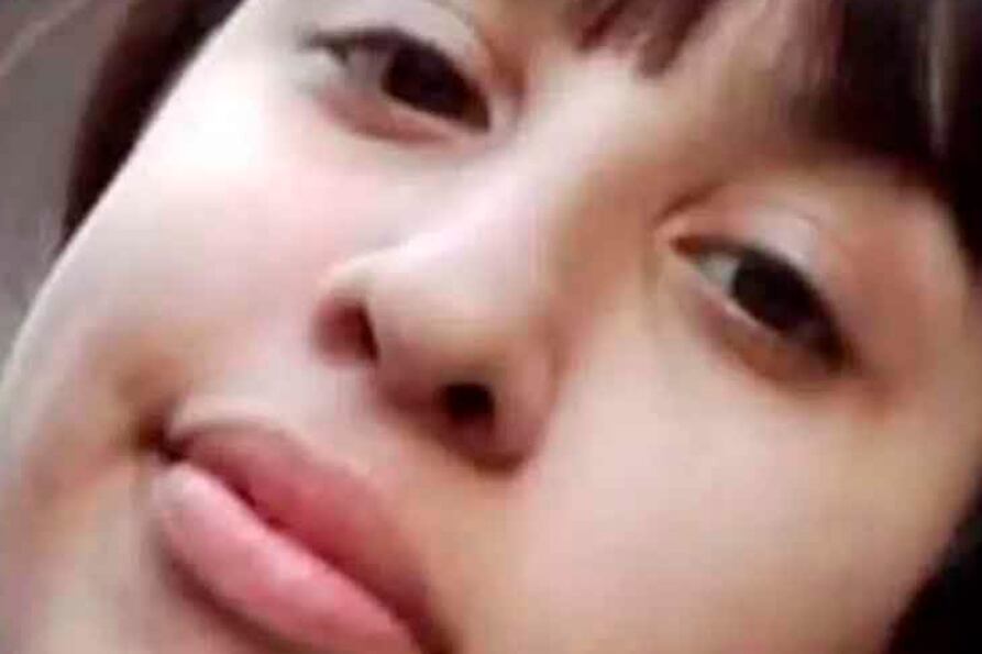 Brisa murió con el 90% del cuerpo quemado.