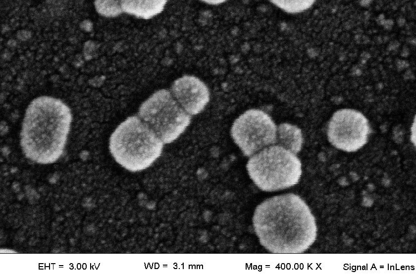 Imágenes de microscopía electrónica registradas durante la investigación del CONICET. Imagen: CONICET.