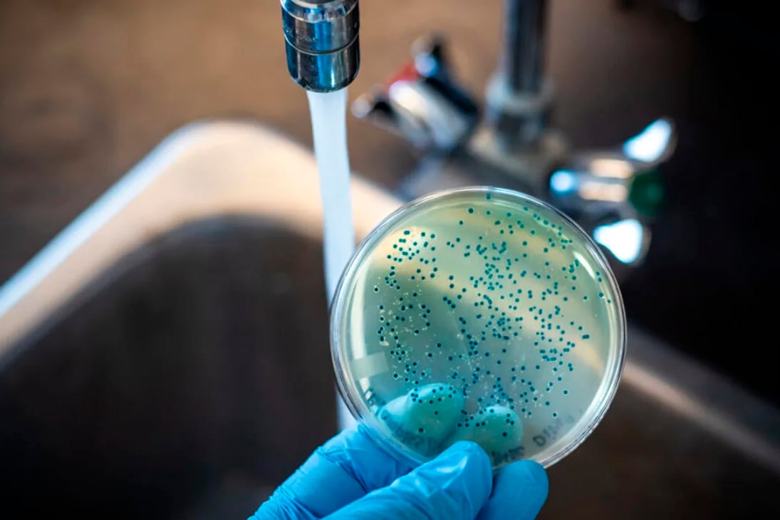 La fiebre tifoidea llega en el agua. 