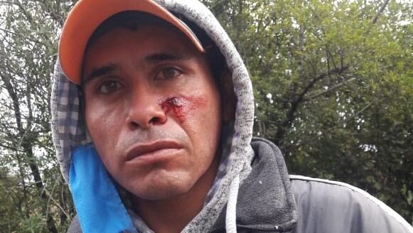 Manifestante herido tras la represión a la protesta del movimiento social 25 de Mayo, en Quitilipi, Chaco. También fueron lesionados integrantes de la Infantería policial de la provincia. 