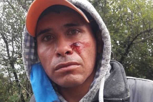 Manifestante herido tras la represión a la protesta del movimiento social 25 de Mayo, en Quitilipi, Chaco. También fueron lesionados integrantes de la Infantería policial de la provincia.