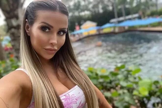 La modelo estuvo tres semanas internada en terapia intensiva luego de la intervención estética. Imagen: IG Lygia Fazio 