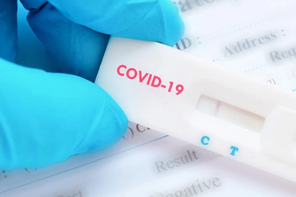 British Airways prueba un test rápido de covid-19 que arroja el resultado en 25 segundos.