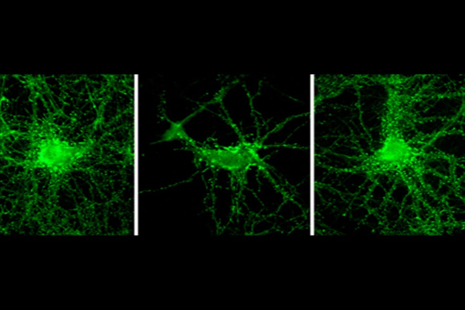 Importante avance científico argentino para combatir el Alzheimer.