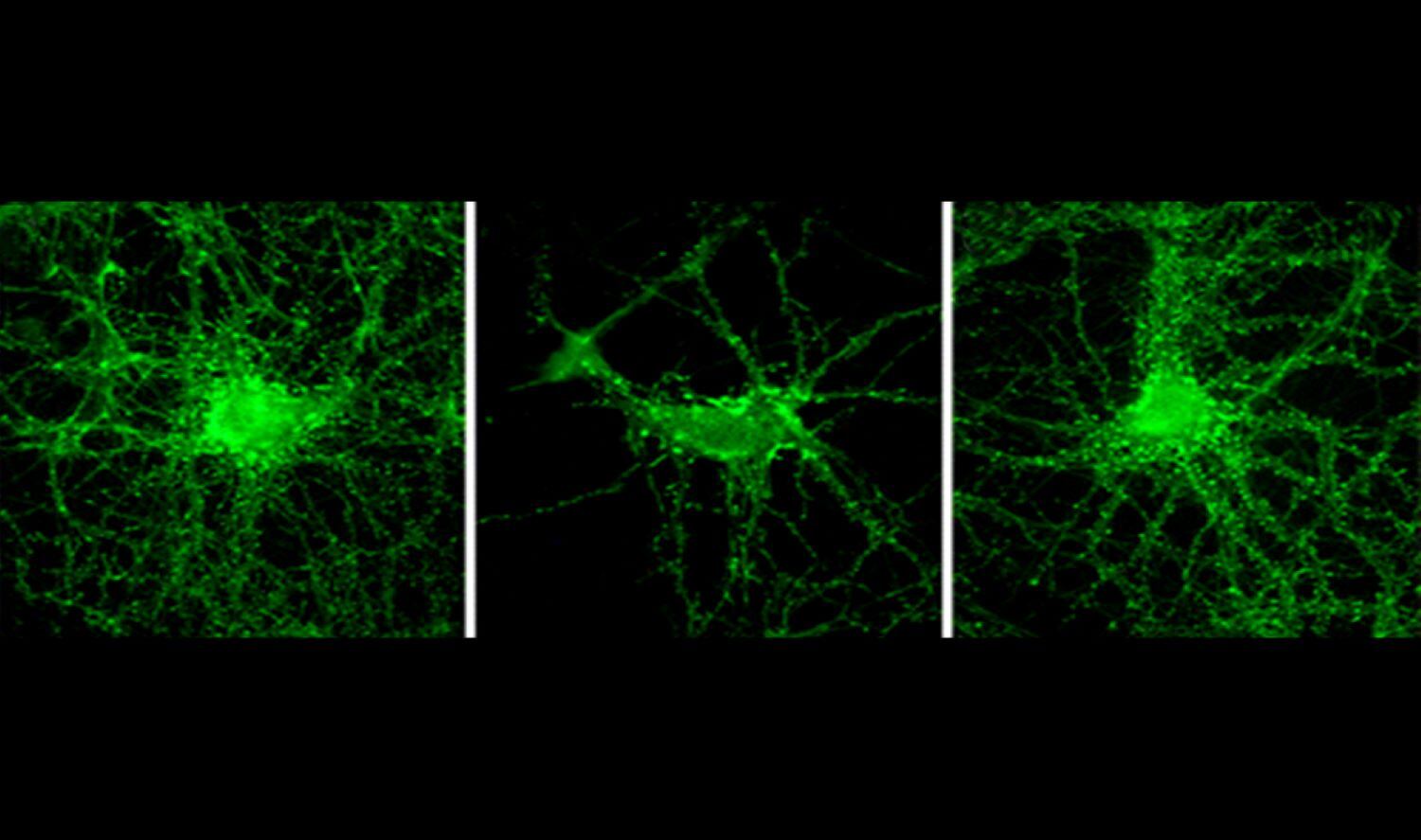 Importante avance científico argentino para combatir el Alzheimer.