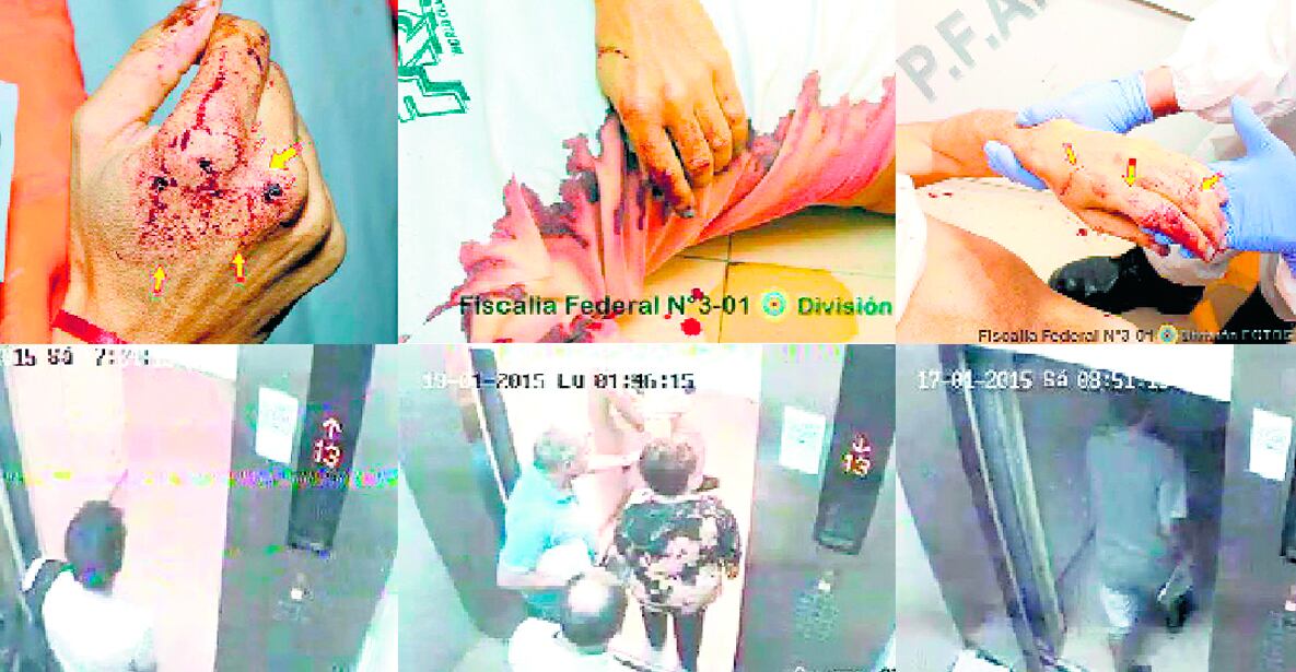 Sangre y restos de conflagración en las manos de Nisman. El ascensor de servicio, con las cámaras que sí funcionaban.