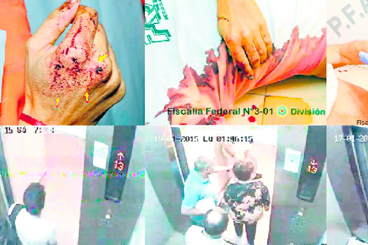 Sangre y restos de conflagración en las manos de Nisman. El ascensor de servicio, con las cámaras que sí funcionaban.