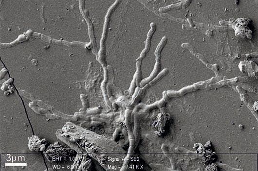La imagen de las neuronas vitrificadas del cerebro y la médula espinal de una víctima de la erupción del Vesubio.