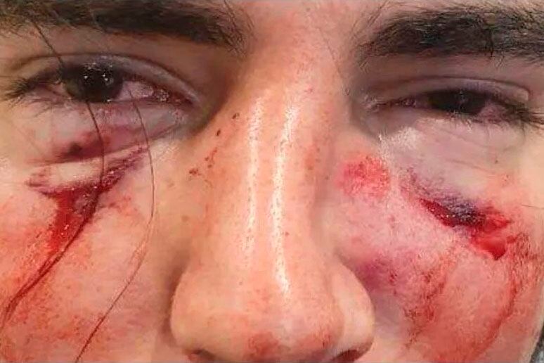 Así quedó Lautaro Insúa, el joven golpeado por rugbiers del Tala Rugby Club de Córdoba.