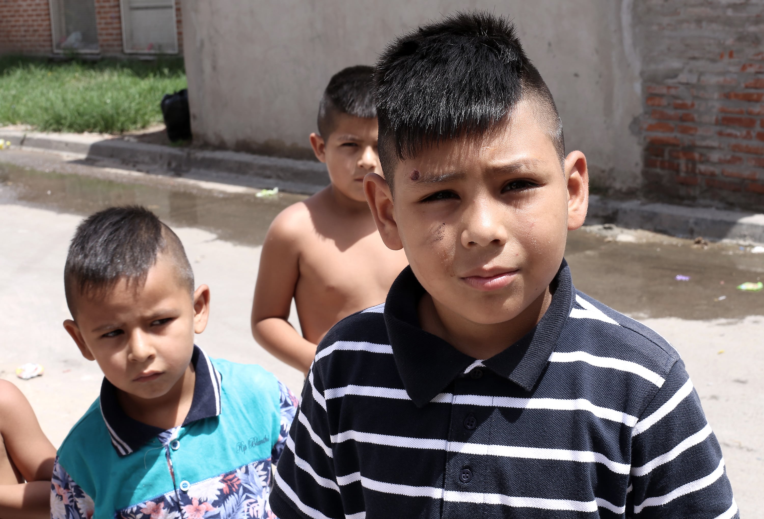 Ariel, de ocho años, recibió balazos en la cara y en la pierna.