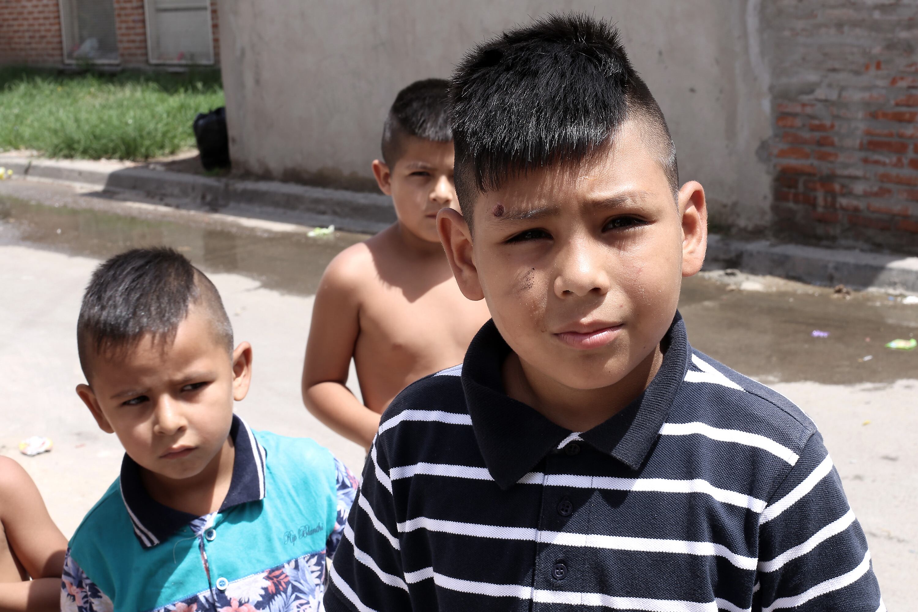 Ariel, de ocho años, recibió balazos en la cara y en la pierna.