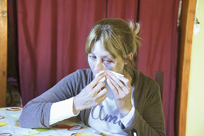 El rostro de Raquel Hartwig muestra el paso de la bestia.