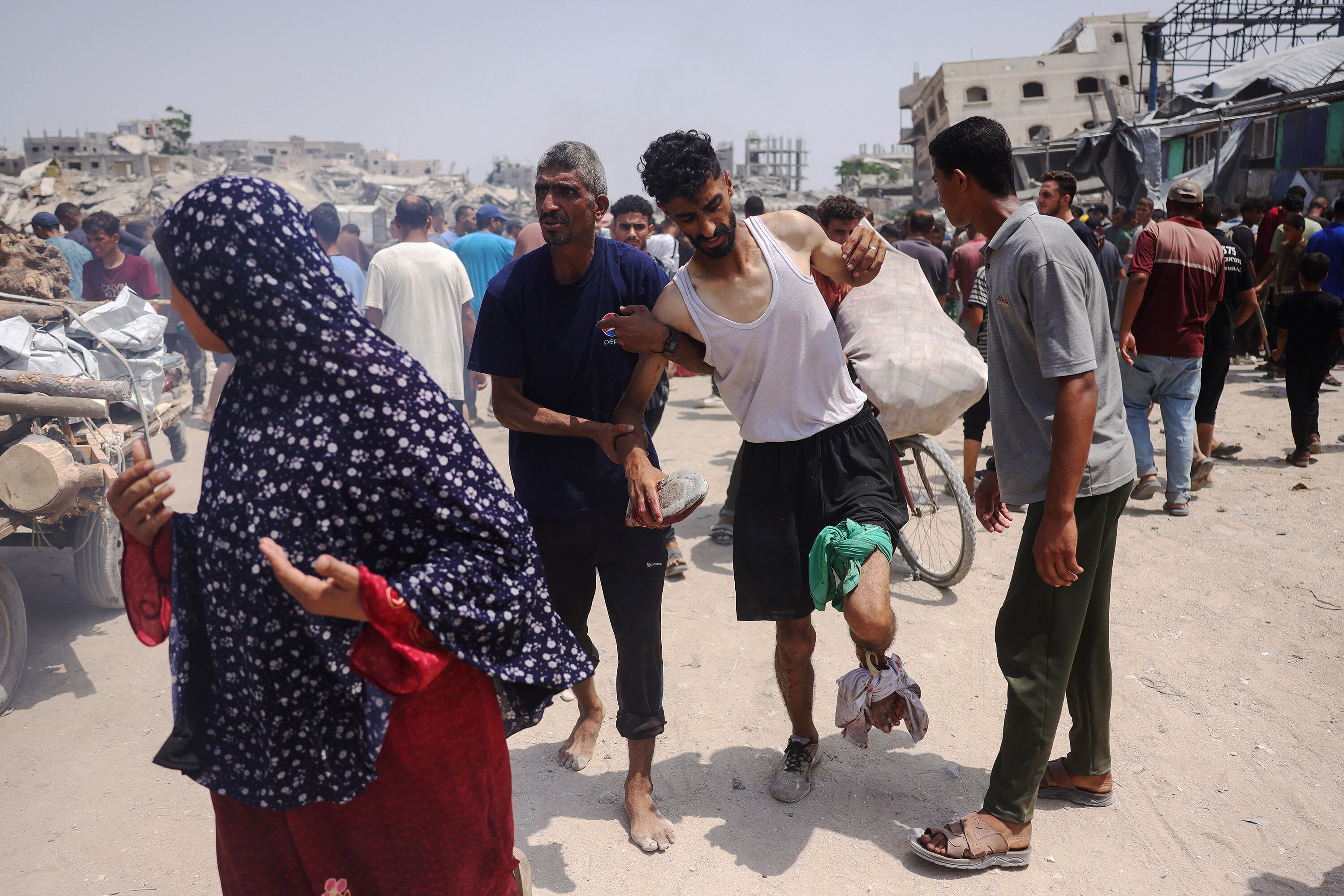 Un hombre gazatí resultó herido por ataques israelíes cerca de un centro de distribución de ayuda al oeste de Jabalia