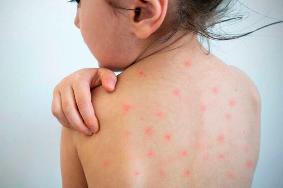 Los servicios de Salud públicos y privados deberán garantizar la vacunación contra el Sarampión, Rubéola, Paperas y Poliomielitis en forma gratuita y obligatoria.