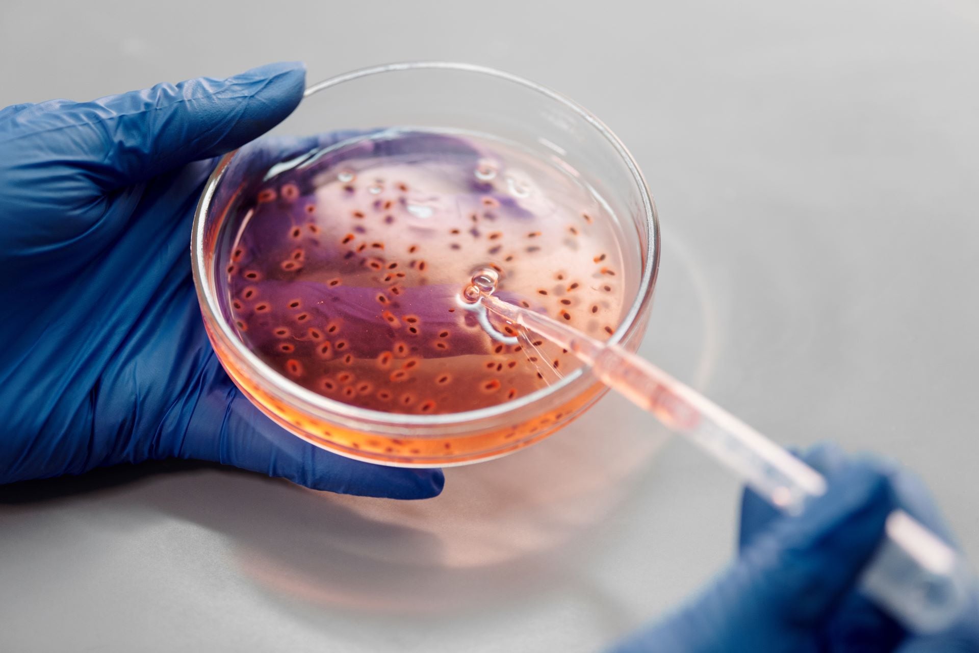 La “súpergonorrea” está en camino a ser uno de los primeros peligros omnipresentes de una era posterior a los antibióticos. (Foto: Pexels)
