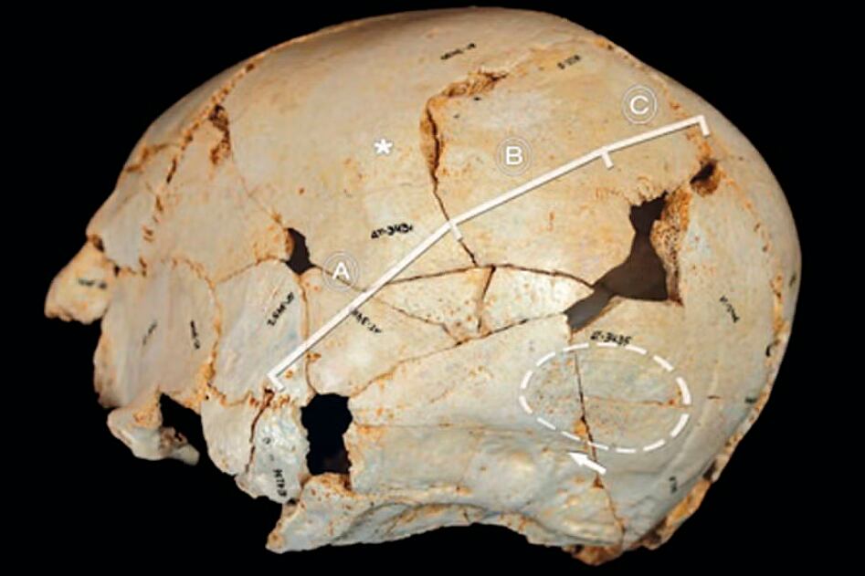 El hallazgo del cráneo de una niña discapacitada indica que fue asistida por el grupo hace 50.000 años