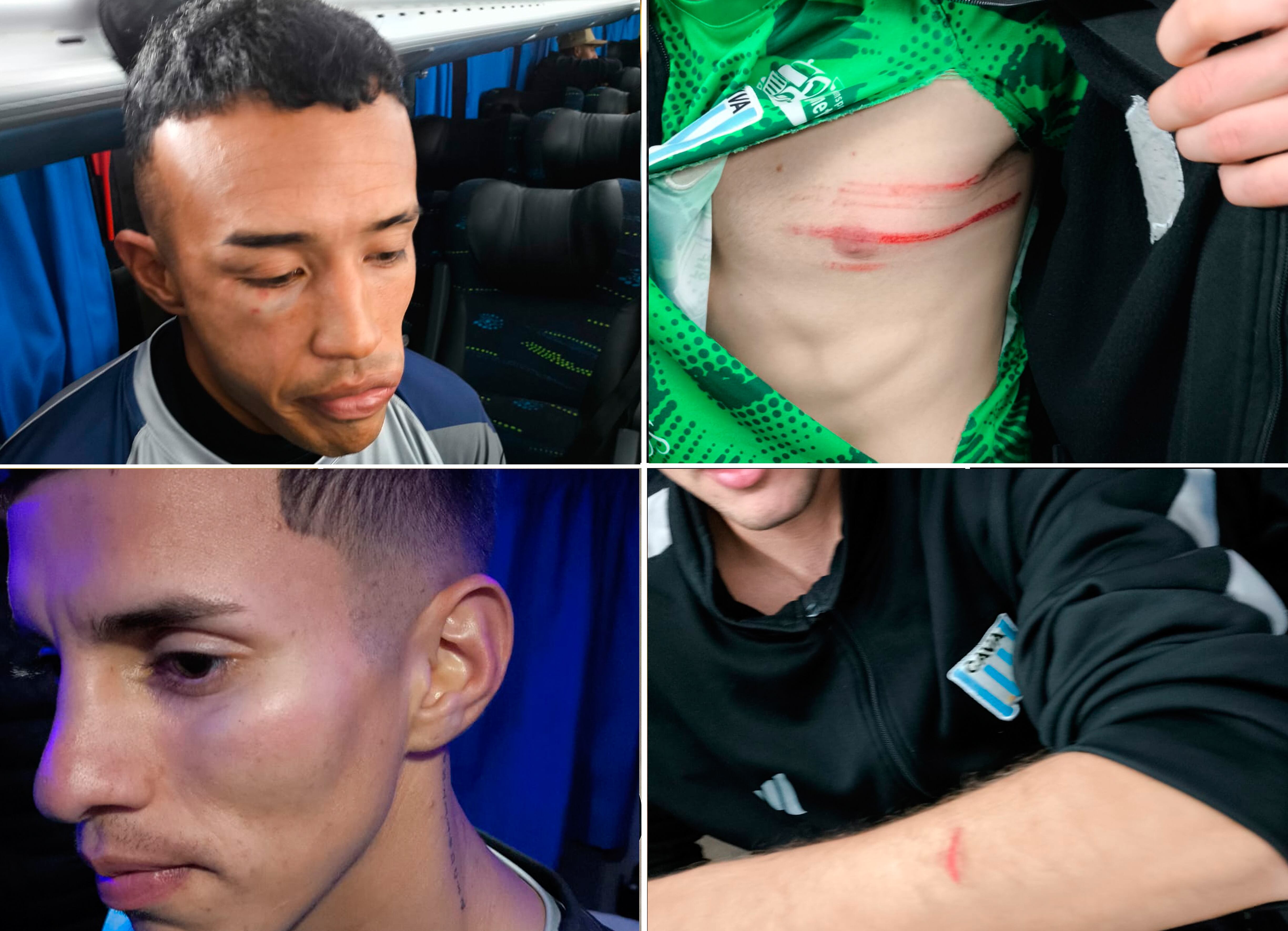 Algunas de las heridas de los futbolistas del CAVA