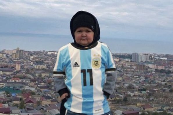 Hasbulla sufre de acondroplasia, un transtorno genético que hace que parezca un niño a pesar de tener 20 años.