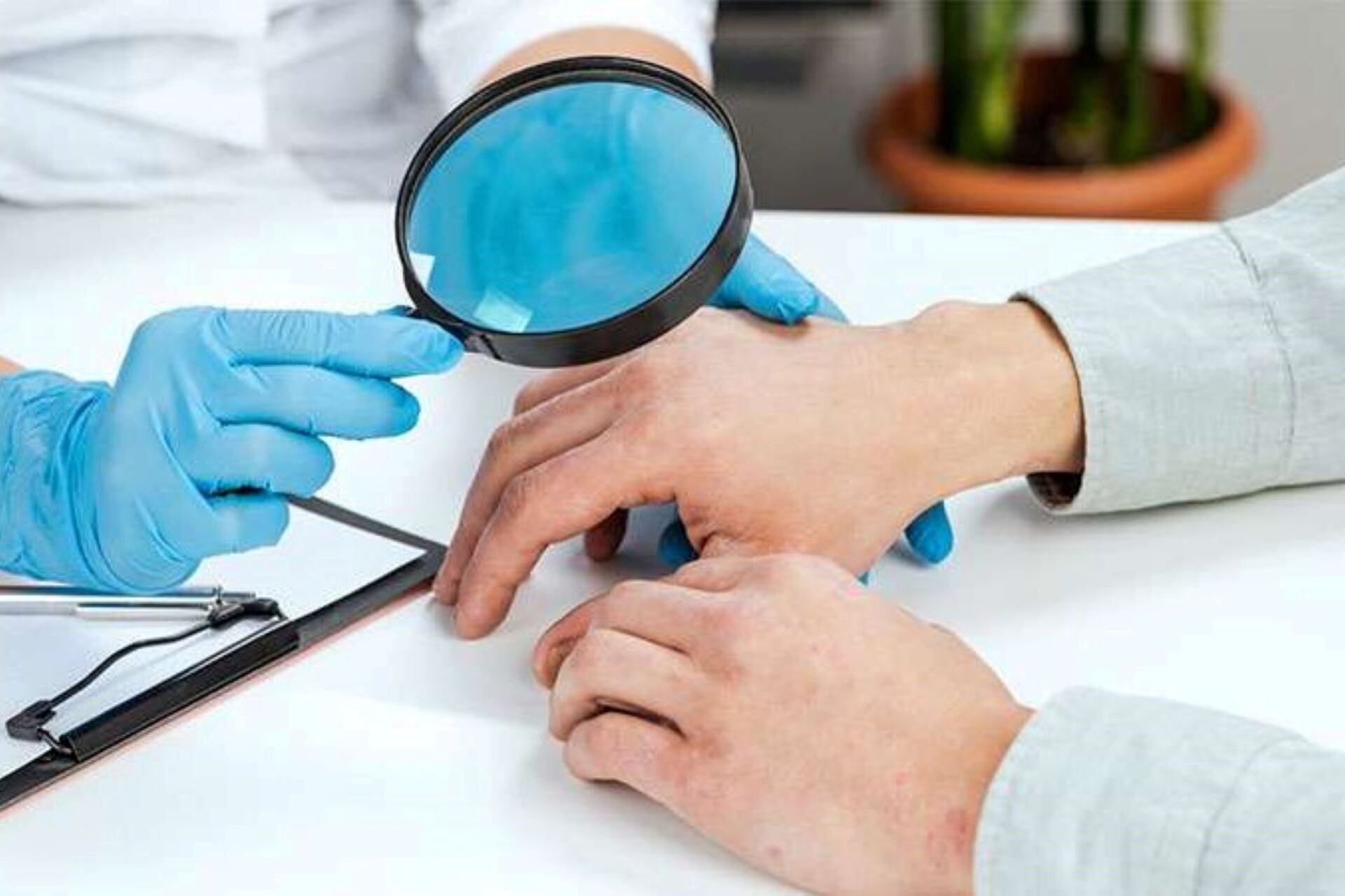 Las enfermedades raras de piel representan el 15% de las patologías genéticas en todo el mundo.