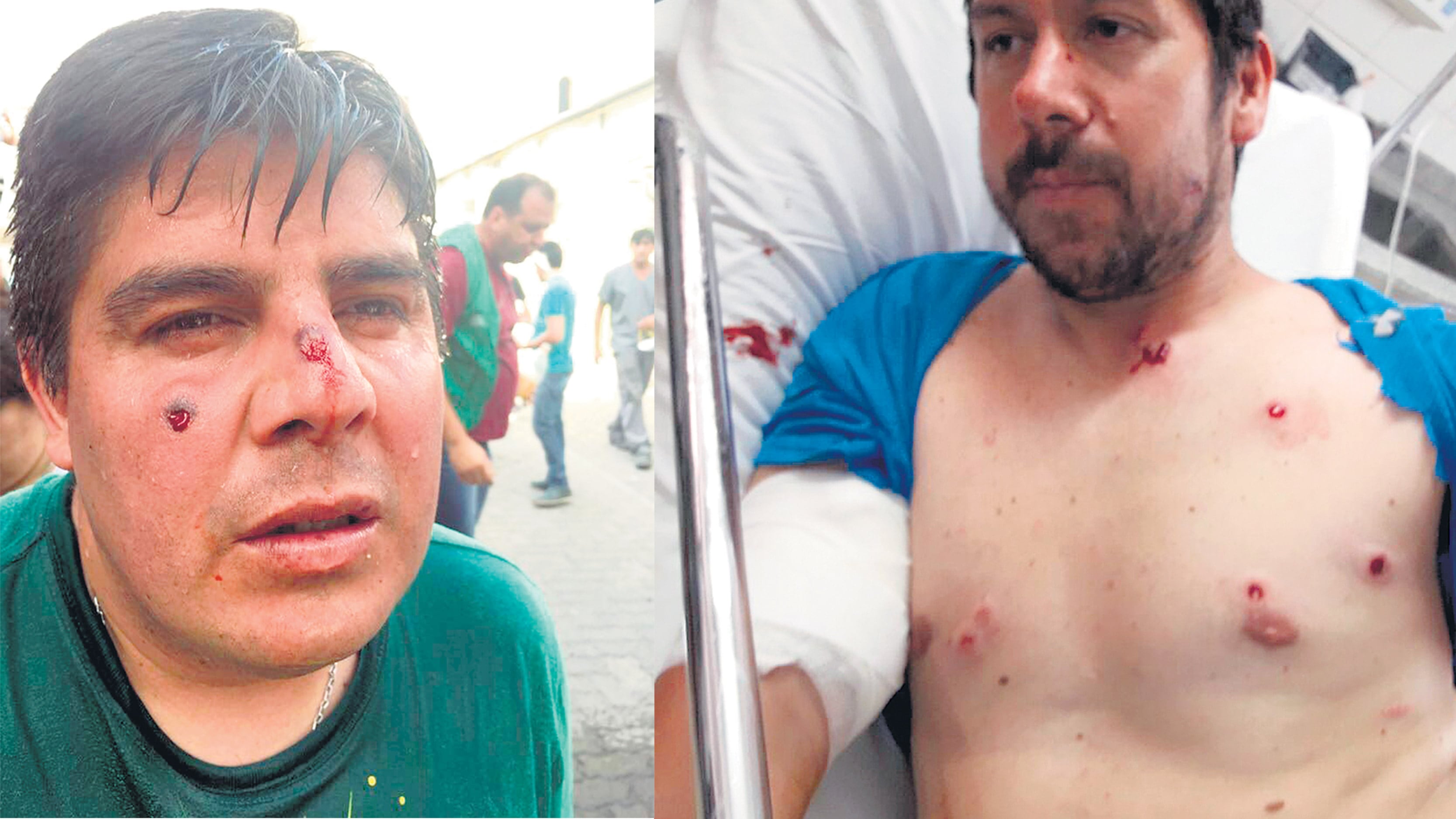 Los manifestantes recibieron balazos de goma y se encontraron dos cartuchos de balas de plomo usados.