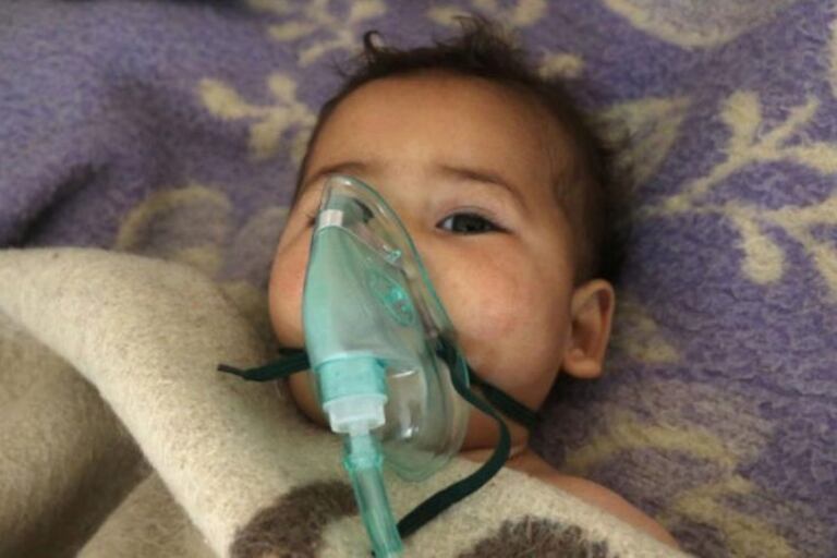 Una niña afectada por el ataque en Jan Seijun.