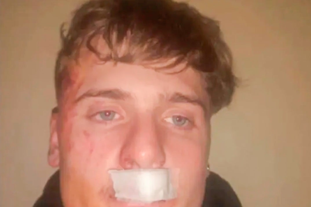 El joven agredido por los rugbiers recibió patadas y golpes de puño en la cabeza.