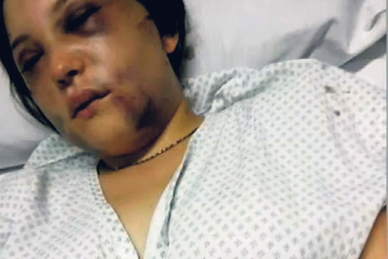 Anoche, la causa fue recaratulada como “lesiones graves”.