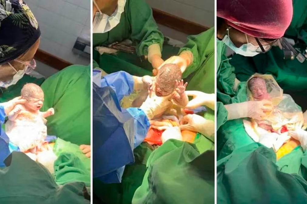 Las trigemelas Ainara, Amira y Ámbar nacieron en el Hospital Público Materno Infantil de Salta