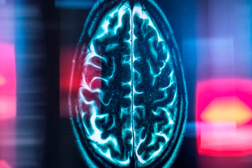 La ciencia busca frenar al Alzheimer.