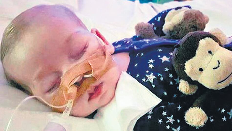 Charlie Gard y una imagen desgarradora.