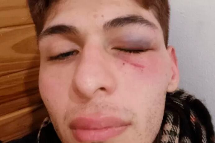 "Toda mi solidaridad con Winfried Fallon Noriega ante la imperdonable agresión que ha sufrido", manifestó el Presidente. 