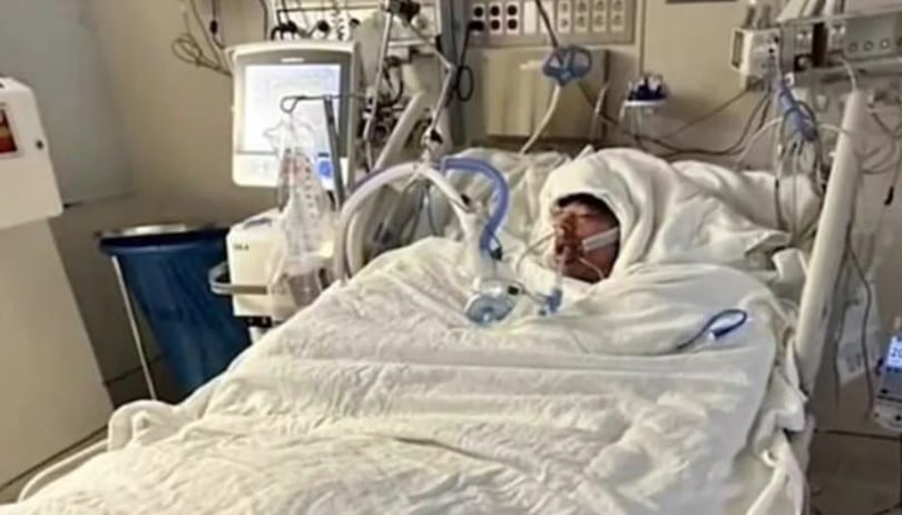 Mason Dark, de 16 años, terminó con casi el 80% de su cuerpo quemado por un challenge de Tik Tok. (Imagen: GoFundme)