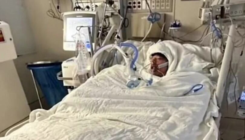 Mason Dark, de 16 años, terminó con casi el 80% de su cuerpo quemado por un challenge de Tik Tok. (Imagen: GoFundme)