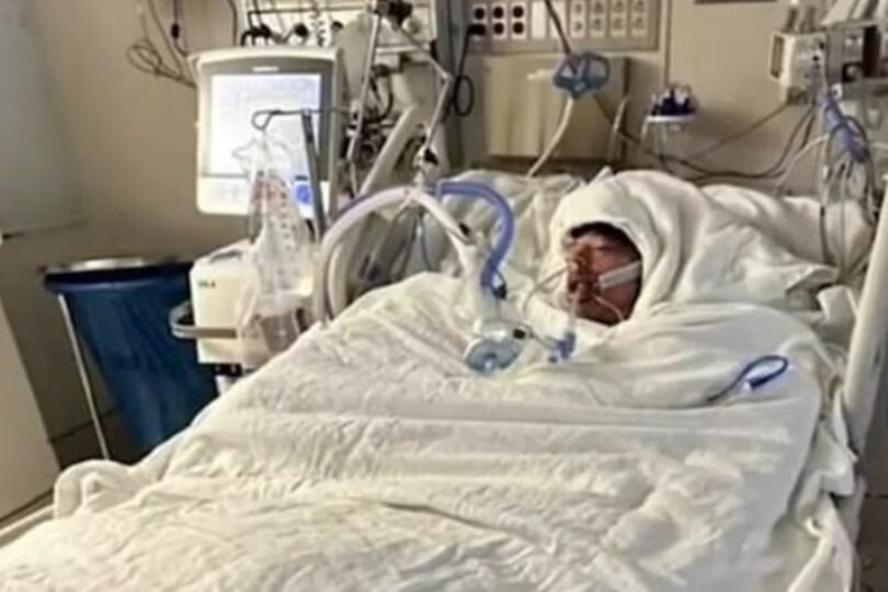 Mason Dark, de 16 años, terminó con casi el 80% de su cuerpo quemado por un challenge de Tik Tok. (Imagen: GoFundme)