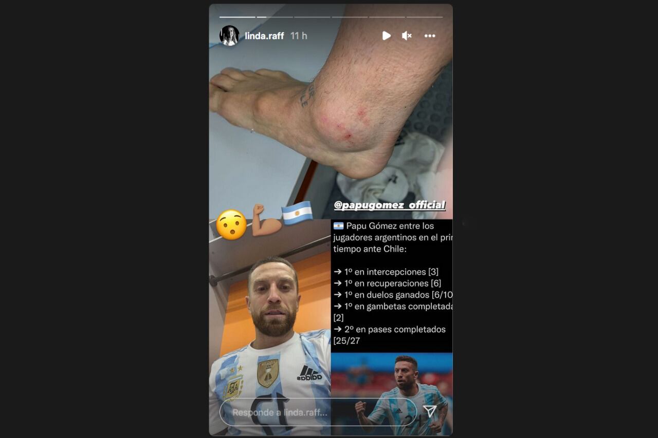 Así quedó el tobillo de Papu Gómez.