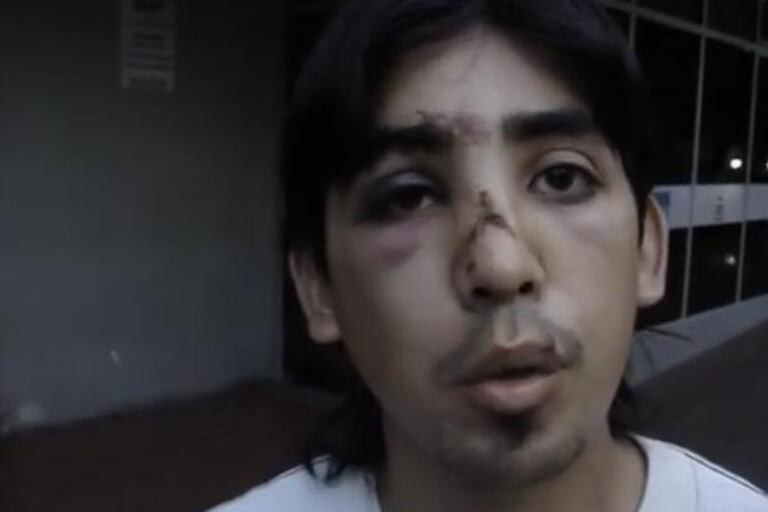 Abel, el joven que sufrió golpes de parte de la policía mendocina.