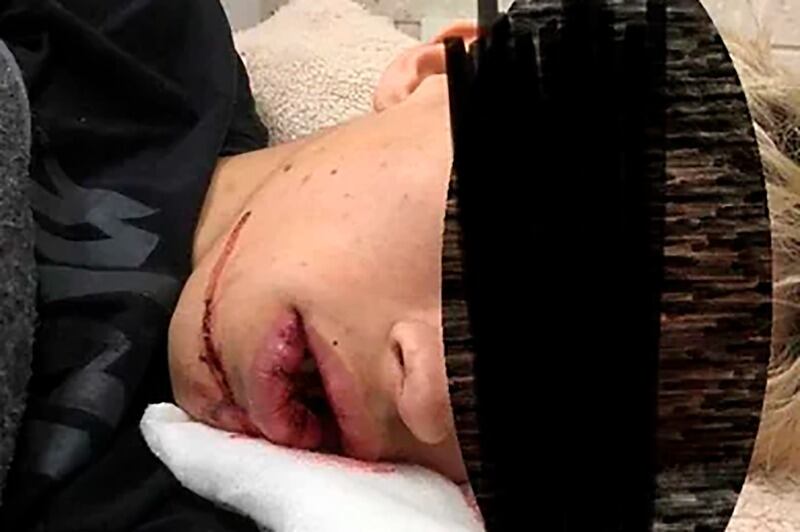 El joven sigue internado en el Hospital Nuestra Señora de Luján.