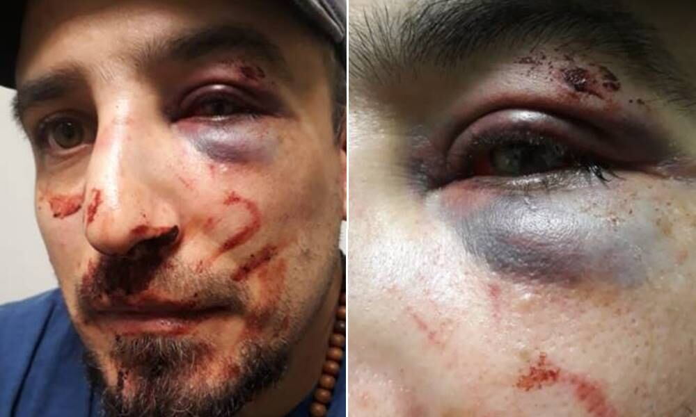 Luciano González permaneció toda la noche en el patio de la comisaría sangrando, con el tabique roto, junto a su pareja y su perro.