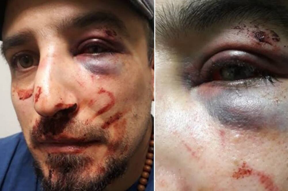 Luciano González permaneció toda la noche en el patio de la comisaría sangrando, con el tabique roto, junto a su pareja y su perro.