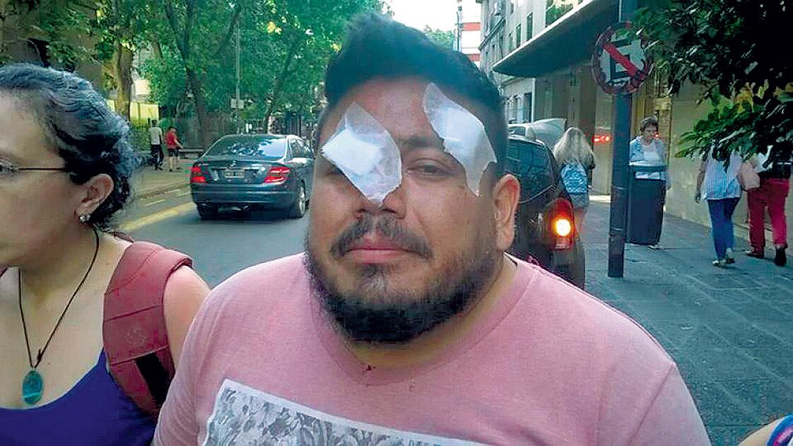 Daniel Sandoval protestaba junto a sus compañeros docentes cuando fue víctima de la brutalidad policial.