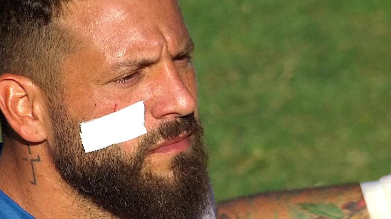 Así quedó el rostro de "Fatura" Broun antes de iniciar el clásico rosarino