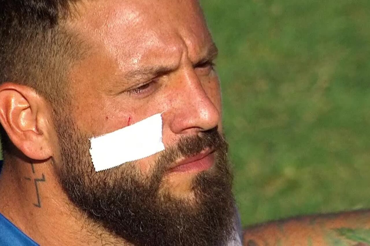 Así quedó el rostro de "Fatura" Broun antes de iniciar el clásico rosarino